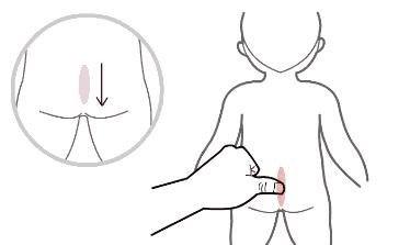 宝宝积食发烧38.5用不用喝退烧药,怎么判断小孩是积食引起的发烧