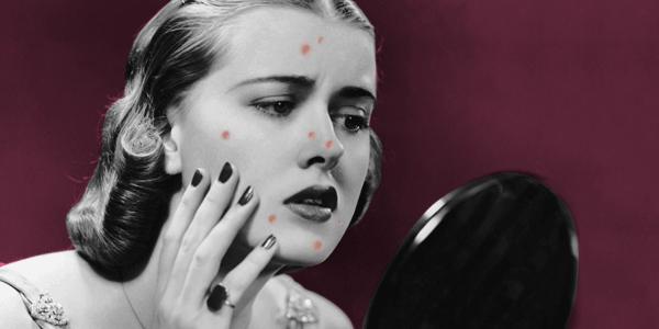 长痘痘后要怎么处理,长痘痘后怎么处理