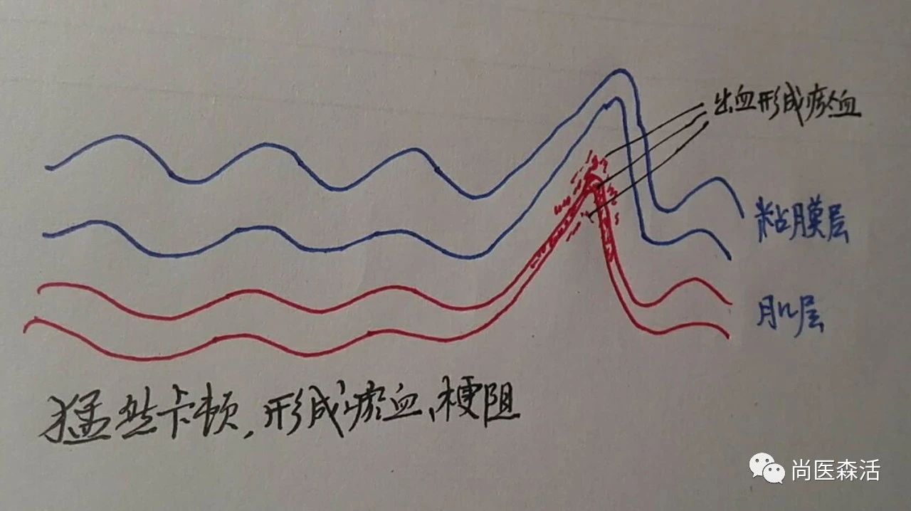 吃饭生气有什么危害视频,生气吃饭后胀气怎么办