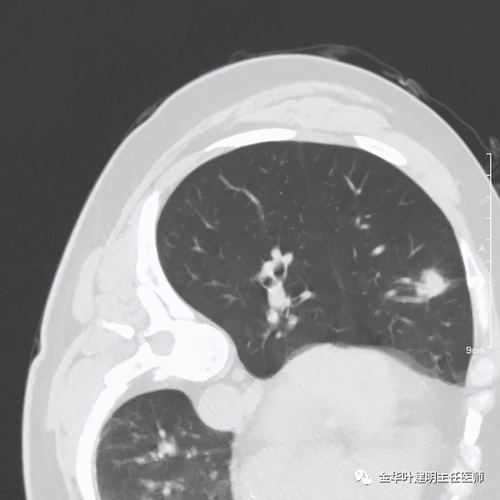 放个大招完整版教学,放个大招完整版前奏