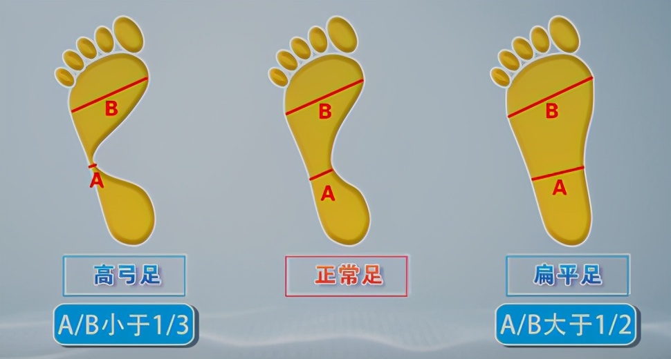 运动不当伤脚筋怎么治,健康之路运动不当脚遭殃