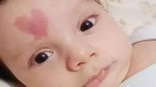 新生儿皮肤问题怎么解决,家有新生儿怎么办