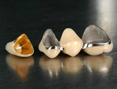 牙齿清理视频解压,烤瓷牙崩瓷了