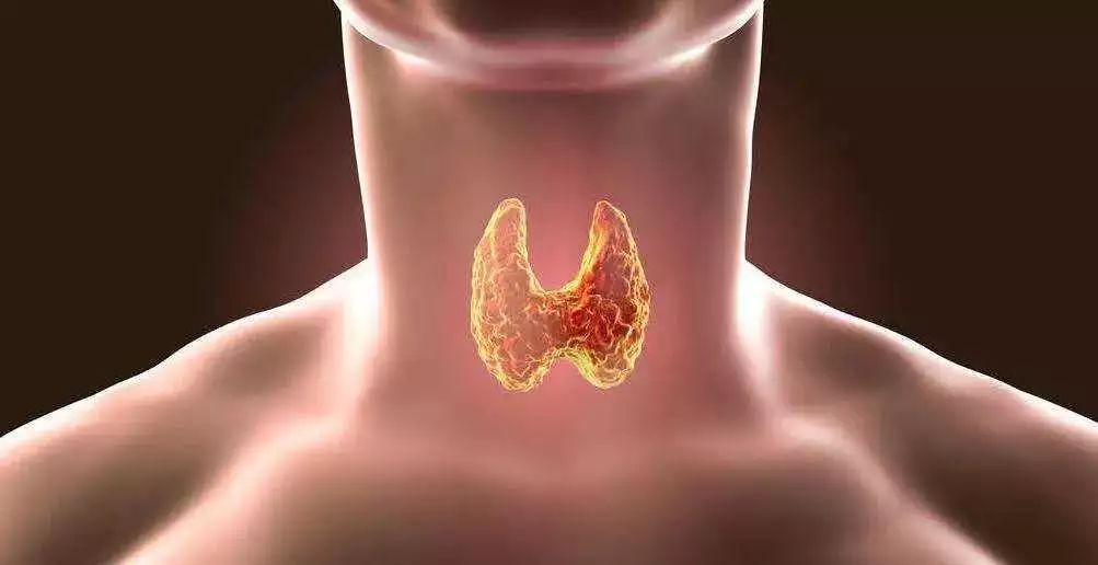 碘摄入量低会得什么病,如果身体缺少碘容易患上哪种疾病