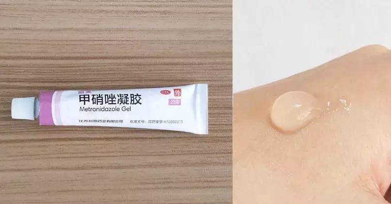 祛痘去黑头有什么药膏推荐,祛痘去黑头真实测评