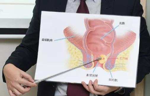 hpv感染和脚气有关吗,hpv感染和哪些肿瘤有关