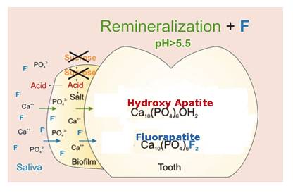 为什么牙齿会蛀牙儿童科普,儿童牙齿长白点是蛀牙吗