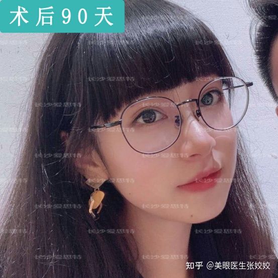 内双的人割双眼皮会更自然吗,怎么把内双变双眼皮的自然方法