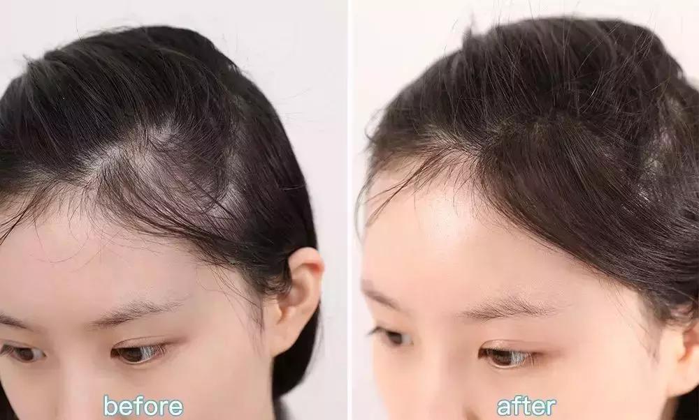 金晨：我们来自拍吧，张歆艺：先分我点头发...