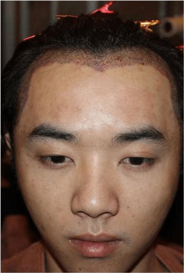 华晨宇被曝整容，本尊怒发声明，爆料者聊天截图曝光自揭背后阴谋