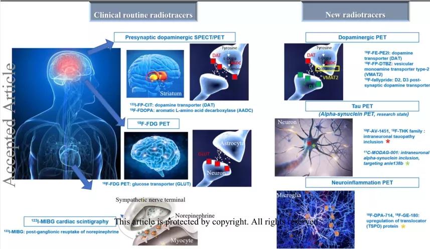 帕金森病的核磁共振影像反应,pet在帕金森病诊断中的意义