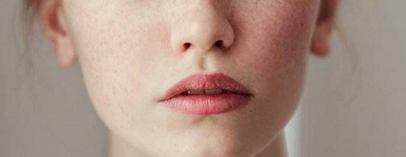 雀斑净能祛除雀斑吗,氢醌乳膏是淡化雀斑还是祛除雀斑