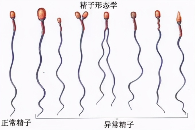 输卵管堵塞做了手术后却没有怀孕，这是为什么？