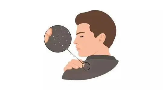 去屑洗发水要挑什么样的,去屑洗发水该怎么选