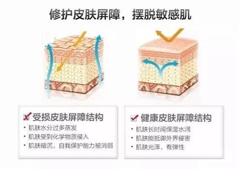 敏感肌不管会怎么样,敏感肌有可能是局部的吗