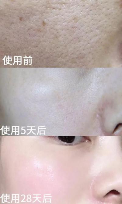 不老女神明星李英爱,51岁李英爱冻龄神颜的原因