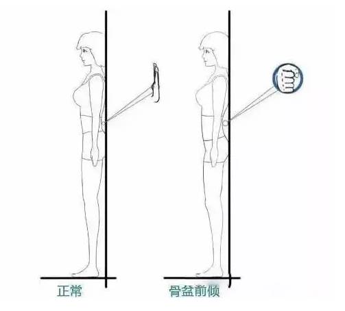 萝卜腿怎么改善肌肉腿,萝卜腿怎么三天快速瘦成筷子腿