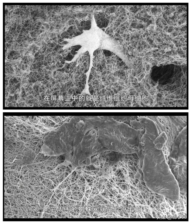 你流失的胶原蛋白补回来了吗,脸部胶原蛋白流失怎么补
