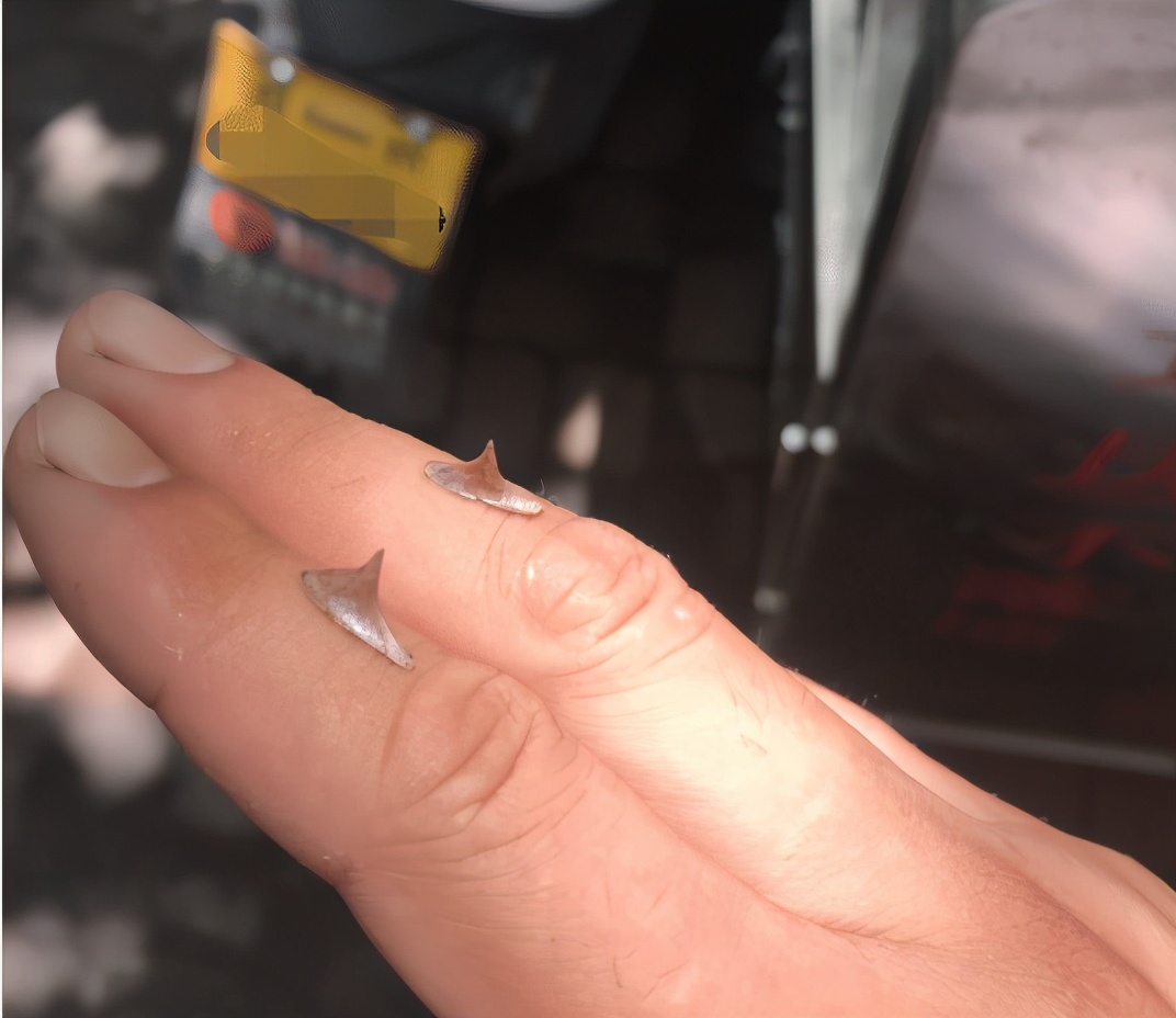 手上长了个手刺怎么办,手上长了一根肉刺很疼