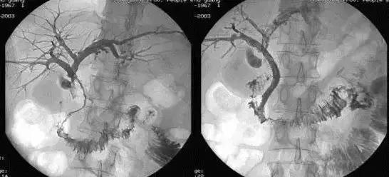 晚期癌症怎么能治,治疗癌症肿瘤的方式都有哪些