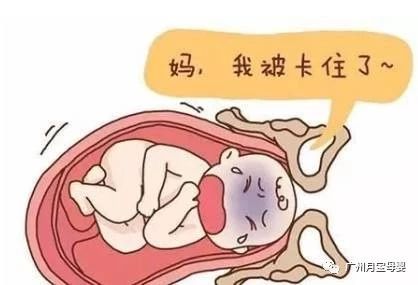 屁股大的女人生育好吗,屁股大的女生好生养