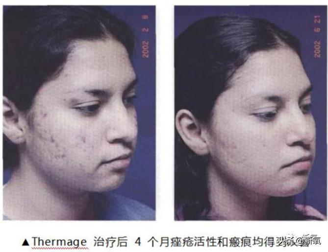 刘诗诗最近生图,刘诗诗旧照脸又胖又大