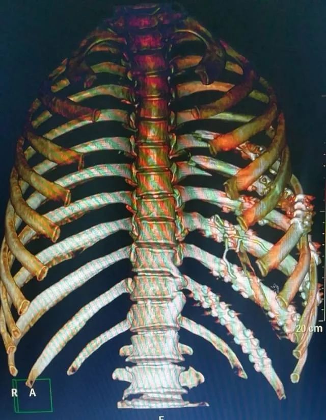 重庆附一院出名的科室有哪些,重庆西南医院擅长哪些科室