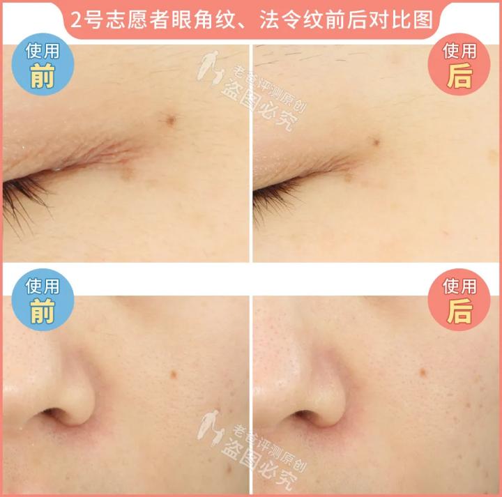 300块的网红美容仪有效果吗,网红家用美容仪测评