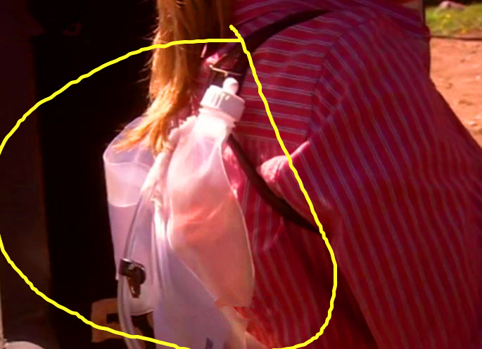 男性和女性排便差异,男性排屁量