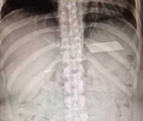 不作死就不会死看看你中了几条,不作死就不会死让人看的头皮发麻