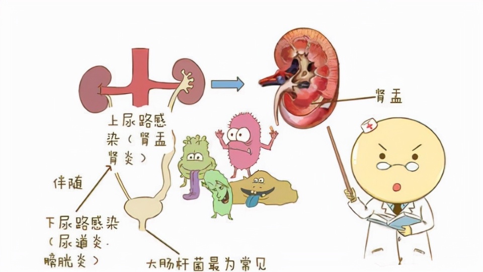 什么原因会引起小儿尿路感染,儿童尿路感染的症状及治疗方法