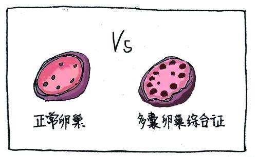 月经来了量少发黑腰痛是怎么回事,大姨妈经期少