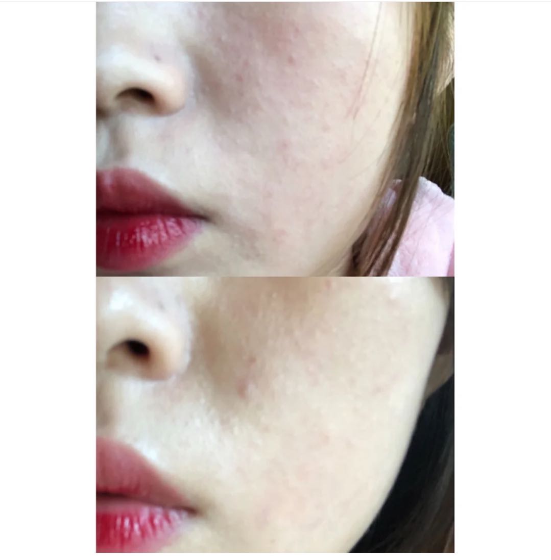 林志颖晒出Kim用的面霜，屈臣氏“销量之王”，比青蛙王子还好用