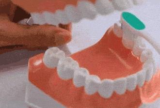 如何治疗和预防牙周炎,牙周炎日常防护