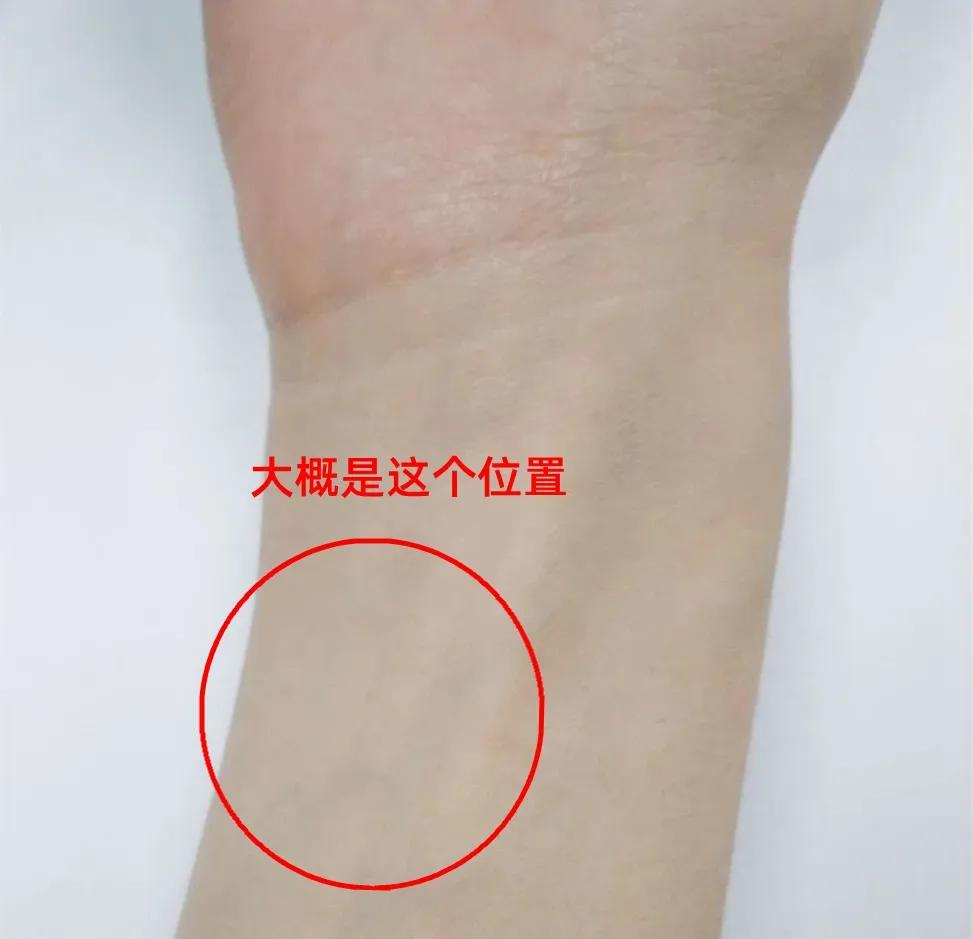 炉甘石不可以涂哪里,炉甘石不能配伍中药