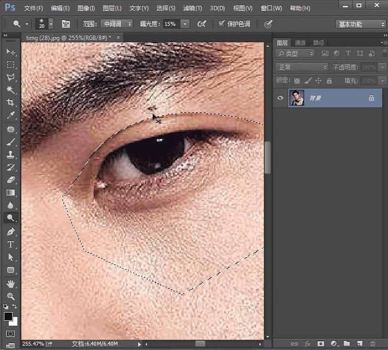 原来双眼皮不好看有必要继续割吗,双眼皮越看越奇怪怎么办
