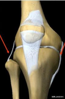 膝关节内侧副韧带损伤的诊疗进展,膝关节内侧副韧带损伤的正确叙述