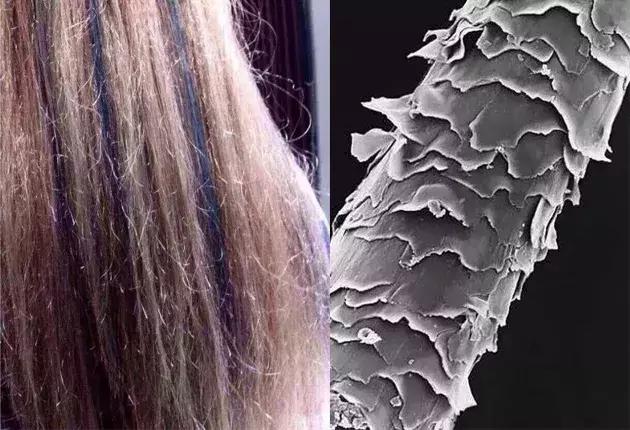 头发毛躁并且脱发推荐洗发水,用什么洗发水改善头皮脱发