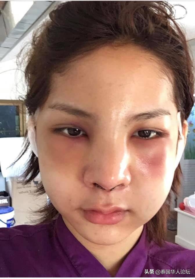 泰国*男美**斥资百万整容变性成美女