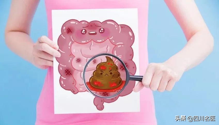 痔疮出血严重是癌症吗,痔疮出血一星期了