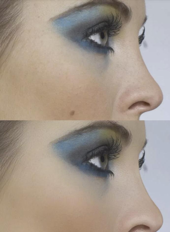 如何美化皮肤好看,皮肤高级美化修饰