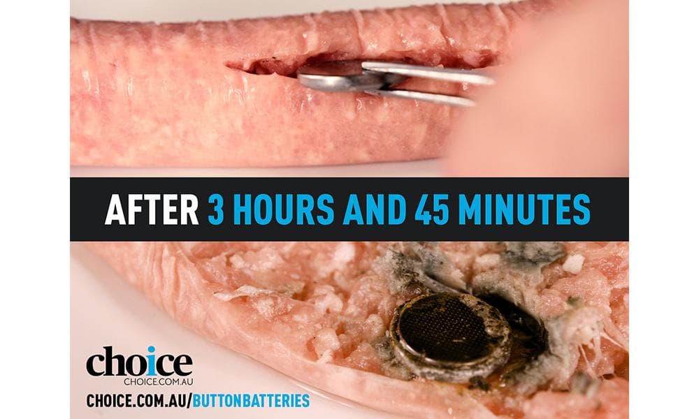 小孩误吞纽扣电池是什么症状,孩子误吞了纽扣电池