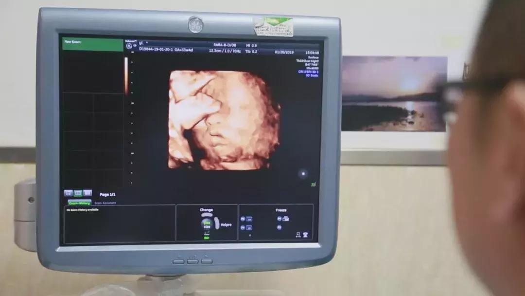 中国首例67岁自然受孕产女,中国首个人工授精出生的女婴