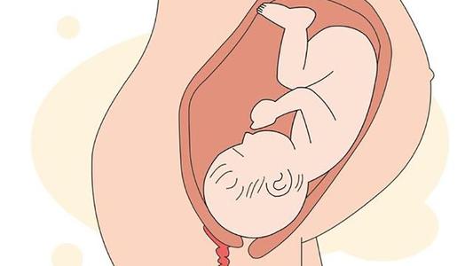 孩子腿不直xo型腿,小孩腿o型腿是怎么导致的