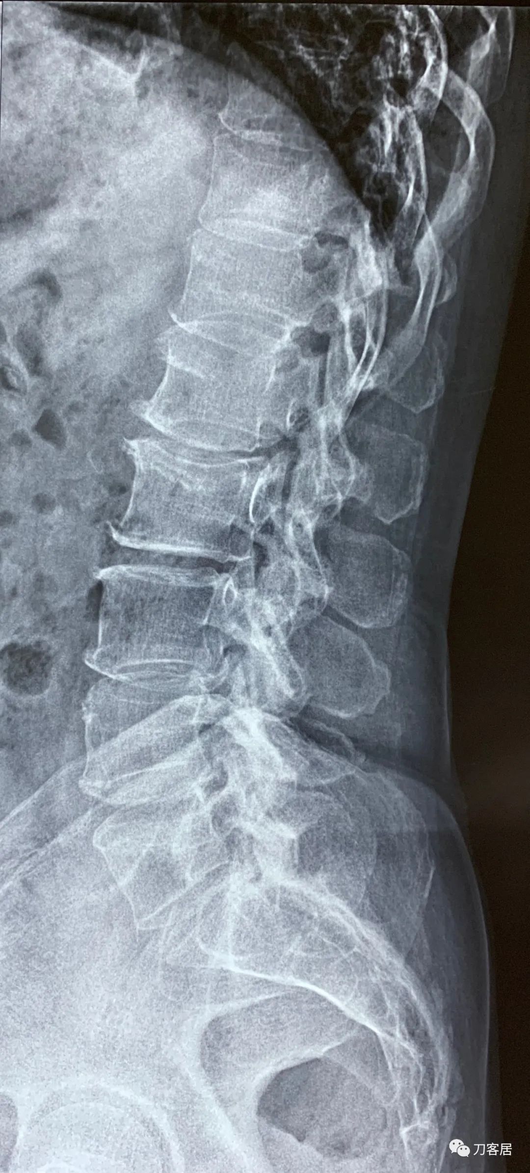 我的门诊病历,我的门诊