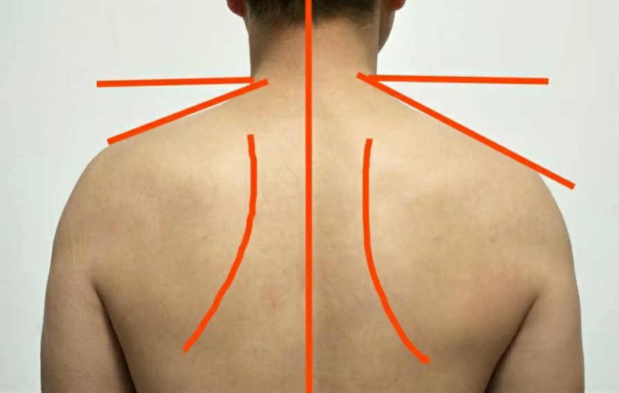 溜肩，长得再瘦体型也垮垮的。但溜肩常见这两种情况，别练错