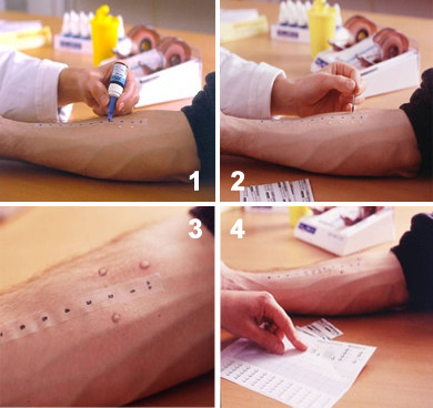 过敏体质的悲哀没人能懂,过敏世界完整版