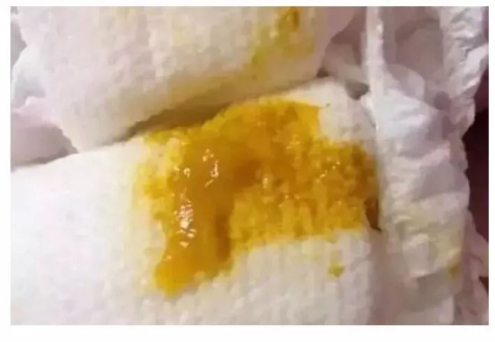 大便正常说明肠道健康吗,宝宝正常大便应该是什么样