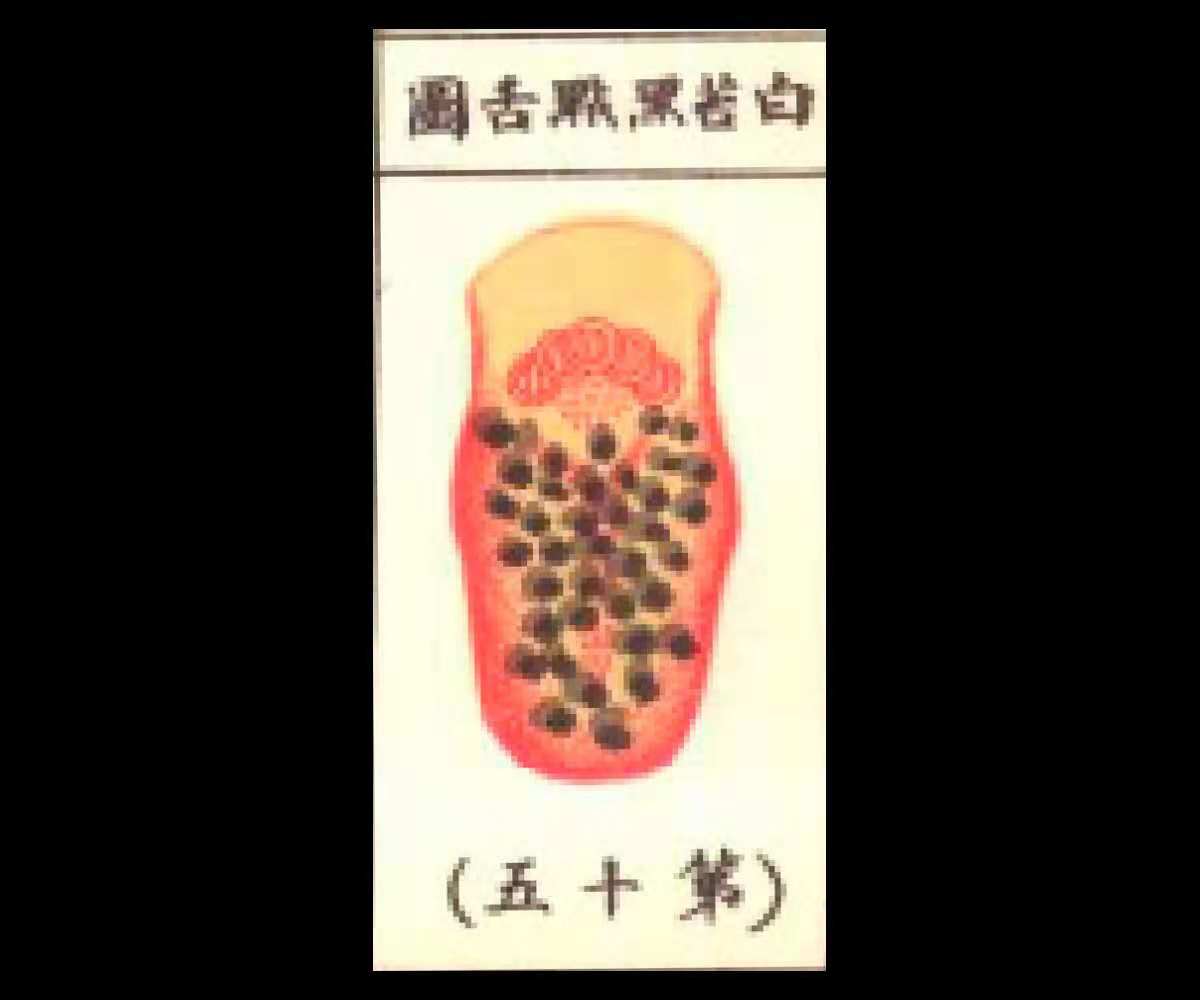 白苔裂纹舌有齿痕是什么原因,舌头白苔厚舌根有红点是什么原因