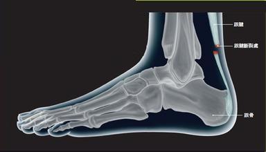 各大媒体评价杜兰特跟腱断裂,勇士宣布杜兰特跟腱断裂